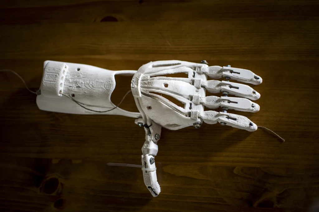3D Prosthetic